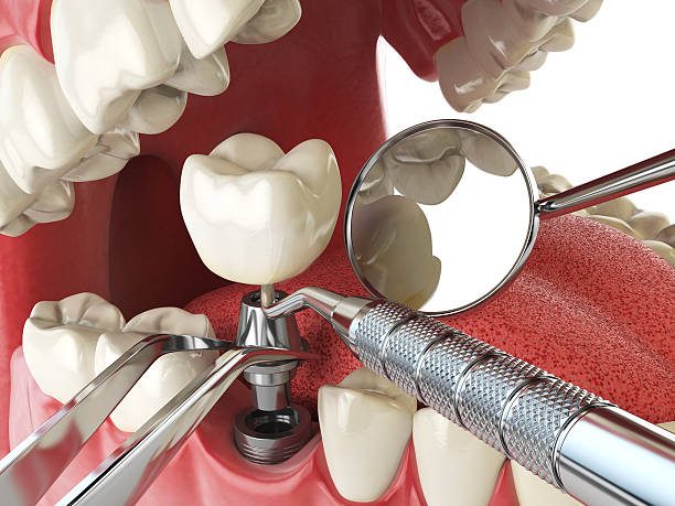 Best Emergency Dental Services for Seniors in French Valley, CA